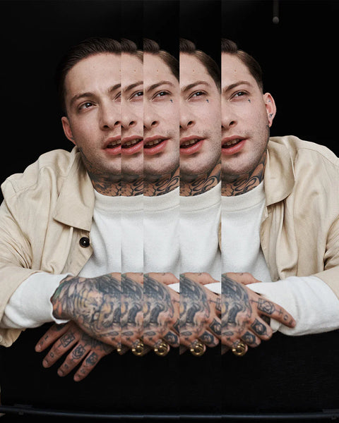 How To Keep Blackheads In Check